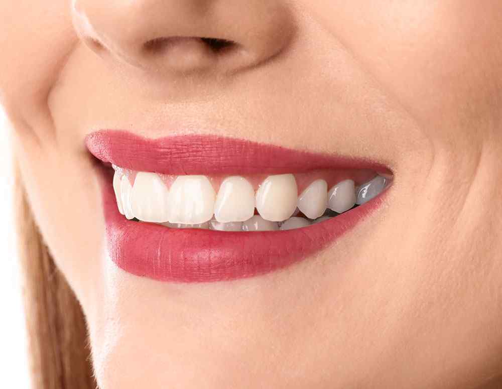 /wp-content/uploads/2020/02/teeth-after.jpg